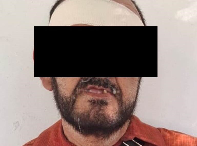 Apresan a sujeto que presuntamente robó 2 vehículos y chocó uno de ellos