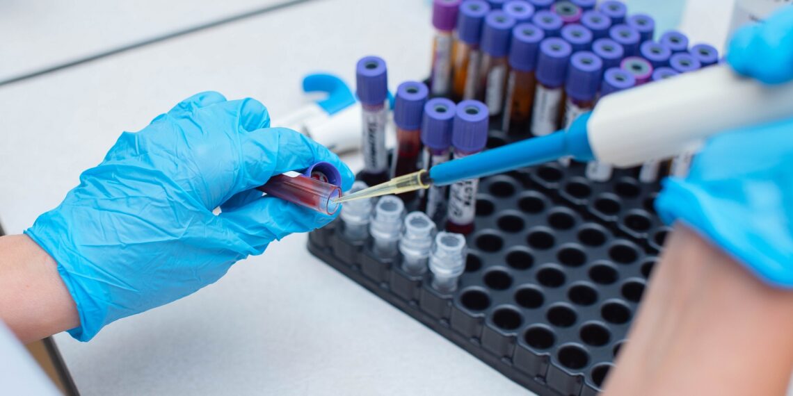 Regreso de Trump a la Casa Blanca pone en peligro la salud mundial