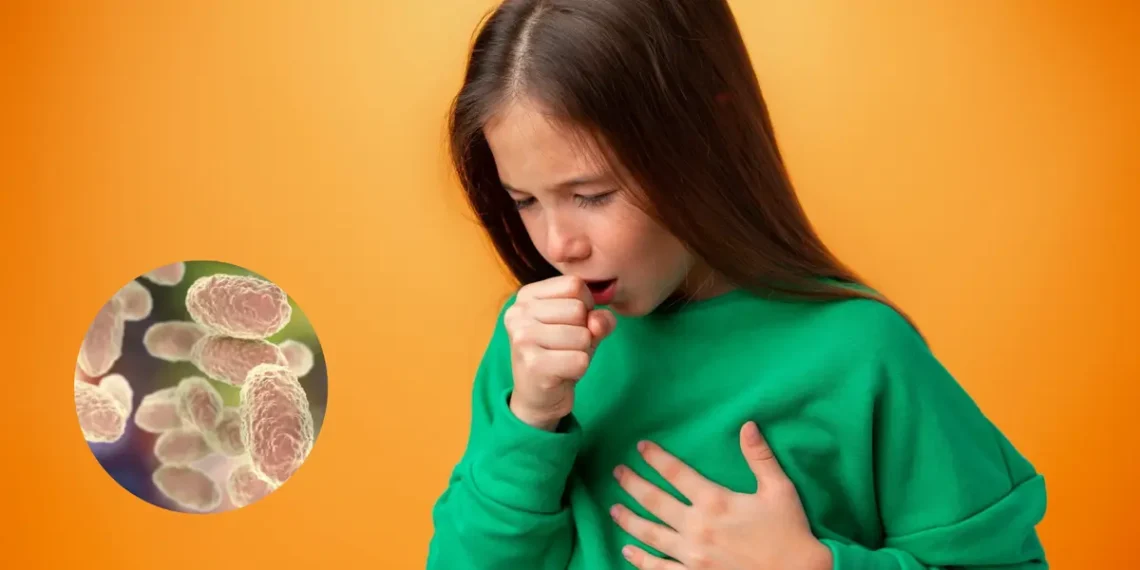 Tos ferina en ascenso: autoridades alertan por aumento de casos en 14 estados