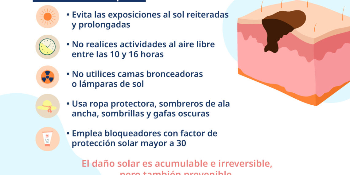 Lanzan campaña para prevenir el cáncer de piel ante el aumento de la radiación solar