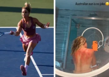 La tenista mexicana Renata Zarazúa muestra las huellas en su espalda por el clima en el torneo de Hobart: “El sol de Australia no es una broma”