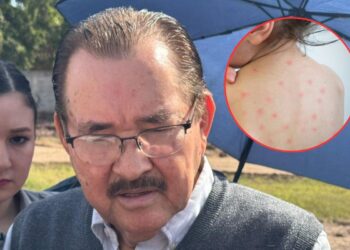 Reportan doce casos de sarampión en Sinaloa: piden reforzar la vacunación
