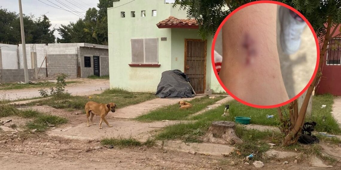 ¡Alerta! Reportan ataque de perros a un menor en el sector Prados del Sur en Los Mochis