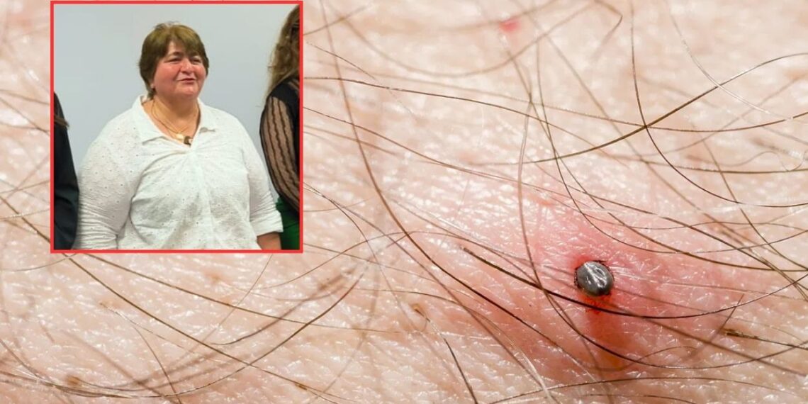 ¡Atención! Un caso de rickettsia prendió alarmas en una comunidad rural de Ahome