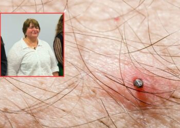 ¡Atención! Un caso de rickettsia prendió alarmas en una comunidad rural de Ahome