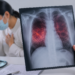 La tuberculosis es curable si se detecta y trata oportunamente