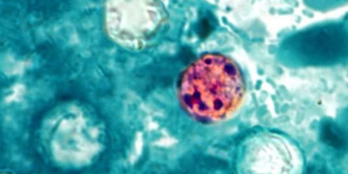 México reporta tres casos de Cyclospora, ¿hay brote de la enfermedad?
