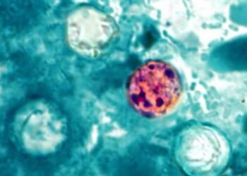 México reporta tres casos de Cyclospora, ¿hay brote de la enfermedad?